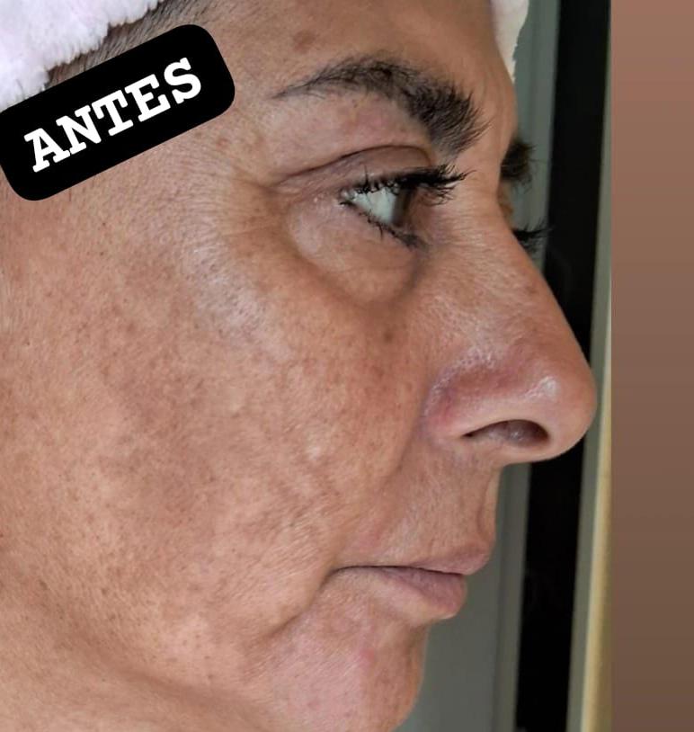 María Bejarano — antes