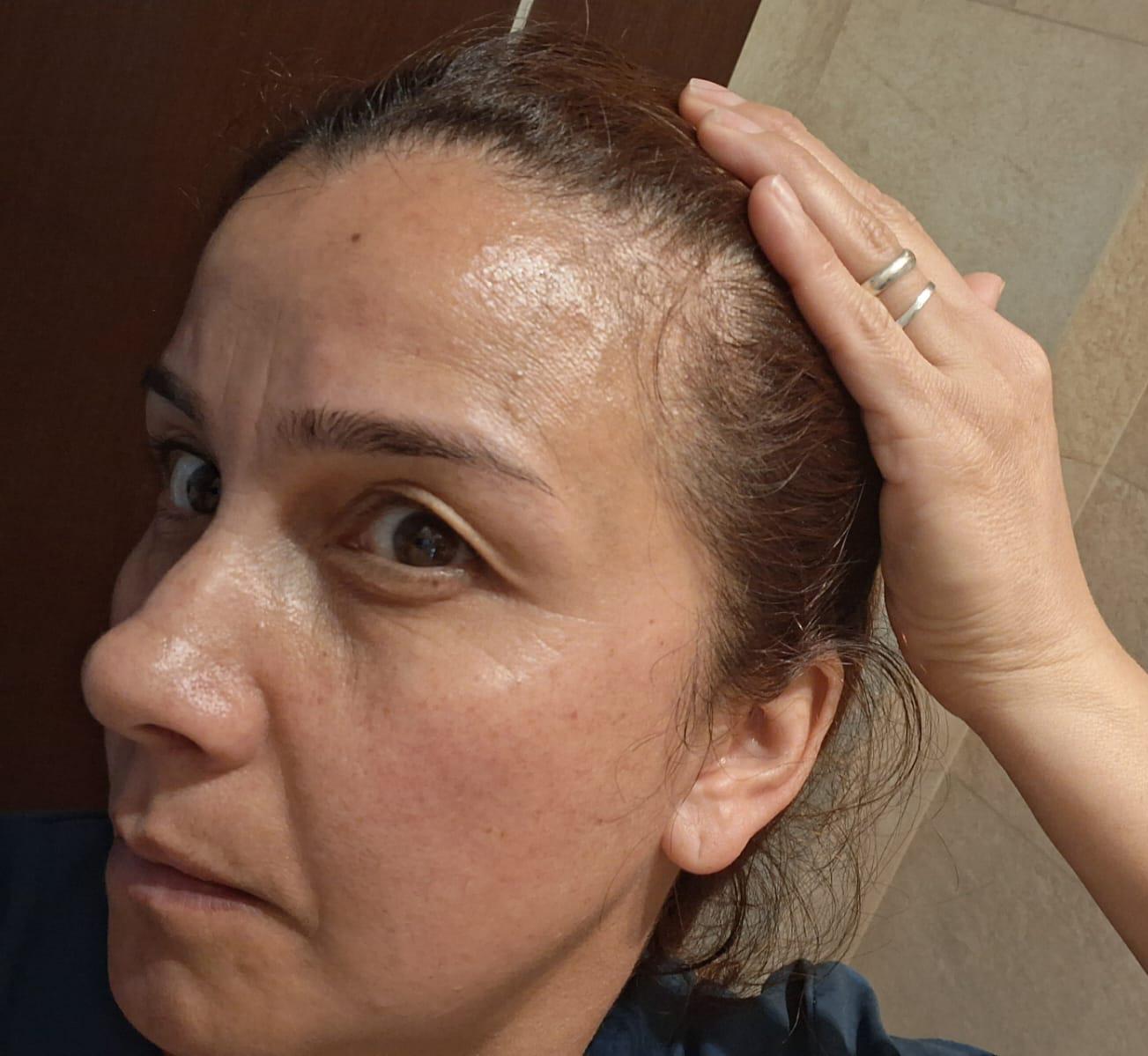 Claudia — antes